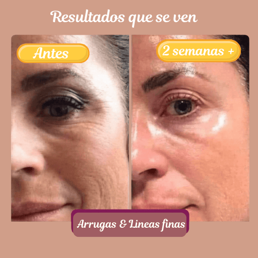 La Mejor Mascarilla Facial de Colágeno- Piel Mas Joven en 7 días
